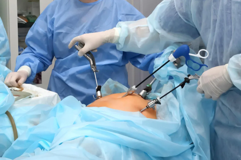 Cirugía laparoscópica para apendicitis en Edo. Méx.